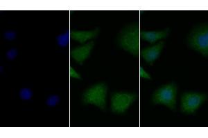 Detection of BDNF in Human Hela cell using Polyclonal Antibody to Brain Derived Neurotrophic Factor (BDNF) (BDNF Antikörper  (AA 139-249))