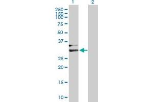 Western Blot analysis of HPX expression in transfected 293T cell line by HPX MaxPab polyclonal antibody. (Hemopexin Antikörper  (AA 1-254))