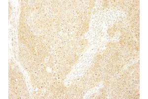 Immunohistochemistry (IHC) image for anti-Breast Cancer Anti-Estrogen Resistance 1 (BCAR1) (AA 275-325) antibody (ABIN7448429)