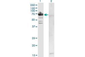 Western Blot analysis of RARS expression in transfected 293T cell line by RARS monoclonal antibody (M02), clone 1A2. (RARS Antikörper  (AA 1-660))