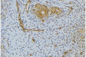 ABIN6276594 at 1/100 staining Human uterus tissue by IHC-P. (HGF Antikörper  (Internal Region))