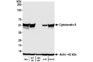 Western Blotting (WB) image for anti-Keratin 8 (KRT8) (C-Term) antibody (ABIN7795706)