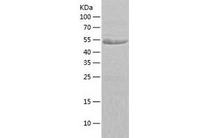 Western Blotting (WB) image for CDK5 Regulatory Subunit Associated Protein 3 (CDK5RAP3) (AA 1-506) protein (His tag) (ABIN7122222) (CDK5RAP3 Protein (AA 1-506) (His tag))