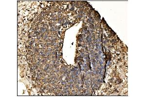 IHC analysis of Arginine Decarboxylase/AZIN2 using anti-Arginine Decarboxylase/AZIN2 antibody (ABIN7599403). (ADC Antikörper  (AA 1-448))