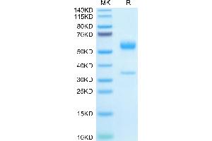 Mouse PGF on Tris-Bis PAGE under reduced condition. (PLGF Protein (AA 19-158) (Fc Tag))