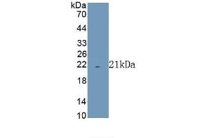 Detection of Recombinant COX4I1, Human using Polyclonal Antibody to Cytochrome C Oxidase Subunit IV Isoform 1 (COX4I1) (COX IV Antikörper  (AA 1-169))