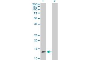 Western Blot analysis of SMA4 expression in transfected 293T cell line by SMA4 MaxPab polyclonal antibody. (SMN1 Antikörper  (AA 1-140))