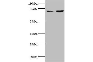 Western blot All lanes: ACSL4 antibody at 2 μg/mL Lane 1: HepG2 whole cell lysate Lane 2: Hela whole cell lysate Secondary Goat polyclonal to rabbit IgG at 1/10000 dilution Predicted band size: 80, 75 kDa Observed band size: 80 kDa (ACSL4 Antikörper  (AA 457-670))