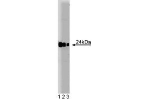 Western blot analysis of Rab8 on a Jurkat cell lysate.