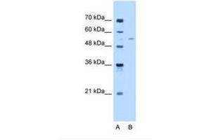 Image no. 1 for anti-Fatty Acyl CoA Reductase 2 (FAR2) (AA 401-450) antibody (ABIN6738351)
