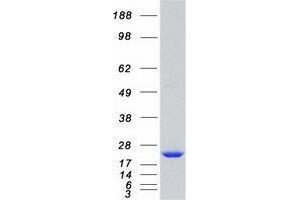 Western Blotting (WB) image for Tumor Protein, Translationally-Controlled 1 (TPT1) protein (Myc-DYKDDDDK Tag) (ABIN2734105)