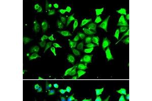 Immunofluorescence analysis of A549 cells using FKBP8 Polyclonal Antibody (FKBP8 Antikörper)