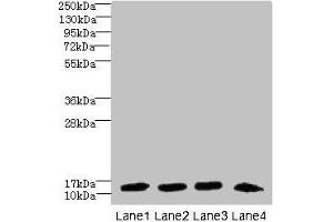Western blot All lanes: DNAL4 antibody at 1. (DNAL4 Antikörper  (AA 1-105))