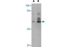Western blot analysis of DHX58 in rat kidney tissue lysate with DHX58 polyclonal antibody  at (A) 1 and (B) 2 ug/mL . (DHX58 Antikörper  (C-Term))