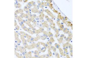 Immunohistochemistry of paraffin-embedded human liver injury using CETN3 antibody at dilution of 1:100 (x40 lens). (CETN3 Antikörper)
