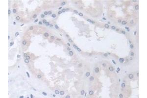 Immunohistochemistry (IHC) image for anti-Chaperonin Containing TCP1, Subunit 2 (Beta) (CCT2) (AA 1-488) antibody (ABIN7441646)