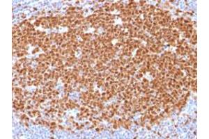 Immunohistochemical staining (Formalin-fixed paraffin-embedded sections) of human tonsil with MCM7 monoclonal antibody, clone MCM7/1468 .