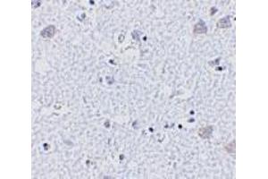 Immunohistochemistry of BRSK1 in human brain tissue with BRSK1 antibody at 5 μg/ml. (BRSK1 Antikörper  (Center))