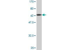 Western Blot detection against Immunogen (67. (MEIS2 Antikörper  (AA 1-381))