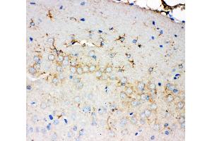 Anti-PMP70 antibody, IHC(P) IHC(P): Rat Brain Tissue (CX3CL1 Antikörper  (C-Term))