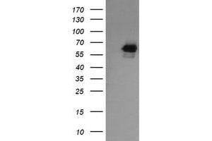 Image no. 6 for anti-RIO Kinase 2 (RIOK2) (AA 277-552) antibody (ABIN1491305) (RIOK2 Antikörper  (AA 277-552))