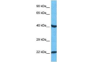 Host:  Rabbit  Target Name:  PAX3  Sample Type:  HepG2 Whole Cell lysates  Antibody Dilution:  1. (Paired Box 3 Antikörper  (C-Term))