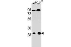 Western Blotting (WB) image for anti-Electron-Transfer-Flavoprotein, alpha Polypeptide (ETFA) antibody (ABIN2996035) (ETFA Antikörper)