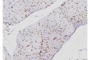 ABIN6269016 at 1/100 staining Human gastric tissue by IHC-P. (Ku70/80 Antikörper)