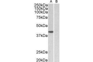 Western Blotting (WB) image for anti-TATA Box Binding Protein (TBP) (Internal Region) antibody (ABIN2465062) (TBP Antikörper  (Internal Region))