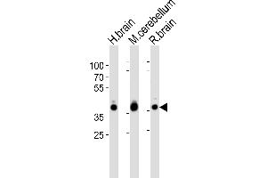 Western blot analysis of lysates from human brain, mouse cerebellum and rat brain tissue lysate (from left to right), using ALDOC Antibody (C-term) (ABIN389207 and ABIN2839365). (ALDOC Antikörper  (C-Term))