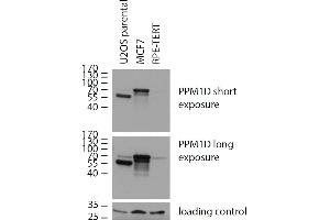 Western blotting analysis of human PPM1D using mouse monoclonal antibody 7E11/C5 on lysates of U2OS parental cells, expressing both natural (70 kDa, low expression) and C-terminally truncated version (55 kDa, high expression) of PPM1D, and on lysates of MCF7 cells (high PPM1D expression) and RPE cells (low PPM1D expression), reducing conditions. (PPM1D Antikörper)