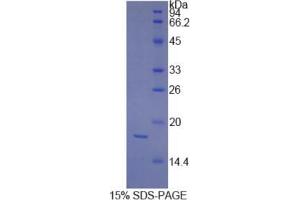 SDS-PAGE analysis of Human PDGFC Protein. (PDGFC Protein)