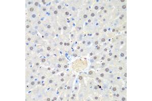 Immunohistochemistry of paraffin-embedded rat liver using WDR48 antibody (ABIN5974731) at dilution of 1/100 (40x lens). (WDR48 Antikörper)