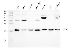 Western blot analysis of Cofilin using anti-Cofilin antibody (ABIN3042746). (Cofilin Antikörper  (C-Term))