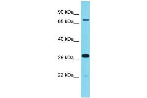 Western Blotting (WB) image for anti-Olfactory Receptor 364, Pseudogene 1 (OLFR364-PS1) (C-Term) antibody (ABIN2788163) (Olfr364-ps1 Antikörper  (C-Term))