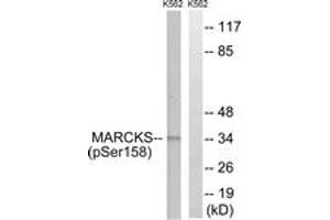 Western blot analysis of extracts from K562 cells treated with EGF 200ng/ml 30', using MARCKS (Phospho-Ser158) Antibody.