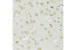 Immunohistochemistry (IHC) image for anti-Solute Carrier Family 37 (Glucose-6-Phosphate Transporter), Member 4 (SLC37A4) (C-Term) antibody (ABIN7270453)