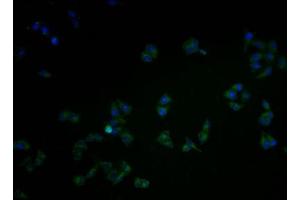 Immunofluorescence staining of Hela cells with ABIN7146440 at 1:100, counter-stained with DAPI. (CAMK2A Antikörper  (AA 321-478))