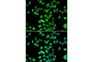 Immunofluorescence analysis of MCF7 cells using Kallistatin (SERPIN) antibody (ABIN6131346, ABIN6147573, ABIN6147574 and ABIN6223161). (SERPINA4 Antikörper  (AA 178-427))