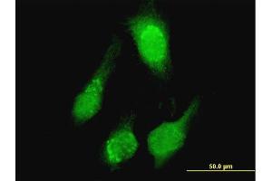 Immunofluorescence of purified MaxPab antibody to TCL1A on HeLa cell. (TCL1A Antikörper  (AA 1-114))