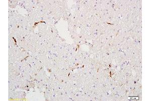 Formalin-fixed and paraffin embedded rat tibia tissue labeled with Anti-Factor VIII (FVIII) Polyclonal Antibody , Unconjugated at 1:300, followed by conjugation to the secondary antibody and DAB staining (Factor VIII Antikörper  (AA 401-500))