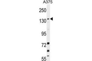 Western Blotting (WB) image for anti-Lysine (K)-Specific Demethylase 4B (KDM4B) antibody (ABIN2996453) (KDM4B Antikörper)