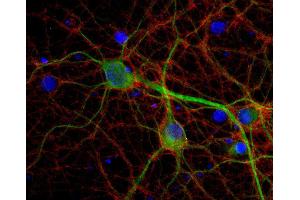 Indirect immunostaining of PFA fixed rat hippocampus neurons with anti-Munc18-1, (dilution 1 : 500; red) and mouse anti-MAP 2 (, dilution 1 : 1000; green). (STXBP1 Antikörper  (AA 580-594))