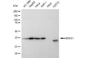 Western blotting analysis using ERCC1 antibody (ABIN7798539). (Rekombinanter ERCC1 Antikörper)
