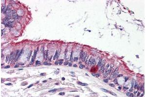 Human Lung (formalin-fixed, paraffin-embedded) stained with ELOVL6 antibody ABIN343916 at 5 ug/ml followed by biotinylated goat anti-rabbit IgG secondary antibody ABIN481713, alkaline phosphatase-streptavidin and chromogen. (ELOVL6 Antikörper  (N-Term))
