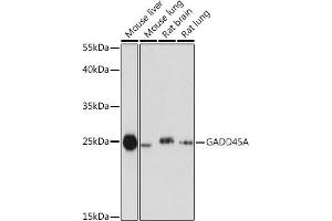 Western blot analysis of extracts of various cell lines, using GA antibody (ABIN6130412, ABIN6140923, ABIN6140926 and ABIN6215461) at 1:1000 dilution.