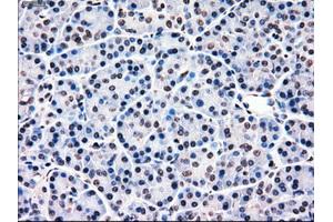 Immunohistochemical staining of paraffin-embedded Ovary tissue using anti-MRI1mouse monoclonal antibody. (MRI1 Antikörper)