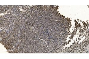 IHC analysis of HNRNPH3 using anti-HNRNPH3 antibody (ABIN7601121).