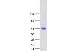 CCDC107 Protein (Myc-DYKDDDDK Tag)