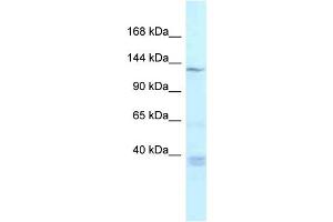 WB Suggested Anti-Tnks Antibody Titration: 1. (TNKS Antikörper  (Middle Region))